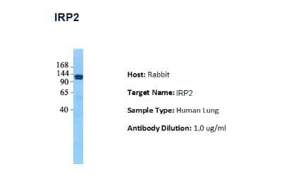 Western Blot: IRP2 Antibody [NBP3-10538] - Host: Rabbit. Target Name: IRP2. Sample Tissue: Human Fetal Lung. Antibody Dilution: 1.0ug/ml